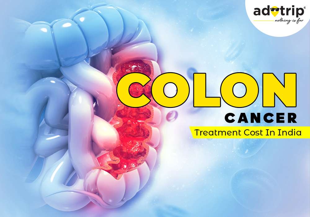 colon cancer treatment cost in india